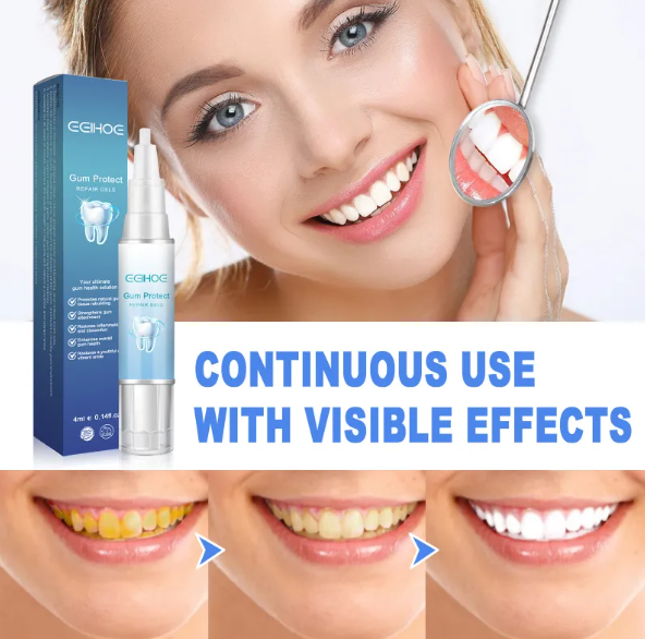 Gum Relief & Teeth Repair Gel – 4ml Oral Care Treatment