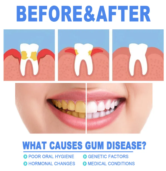 Gum Relief & Teeth Repair Gel – 4ml Oral Care Treatment