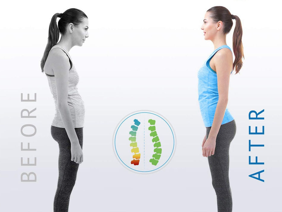Posture Corrector Brace – Back & Shoulder Support for Men & Women