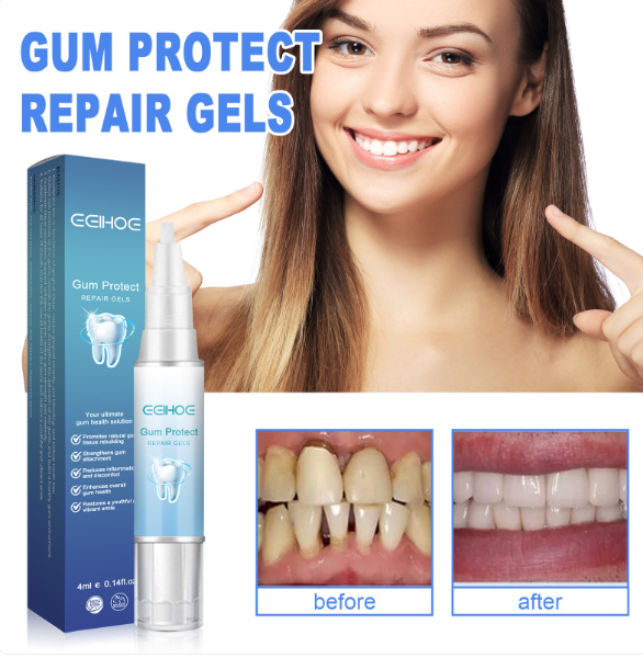 Gum Relief & Teeth Repair Gel – 4ml Oral Care Treatment